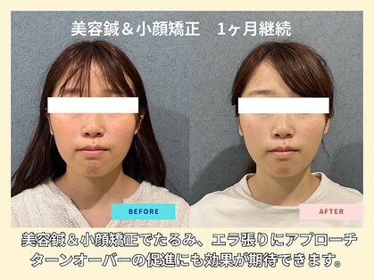 晴々の写真