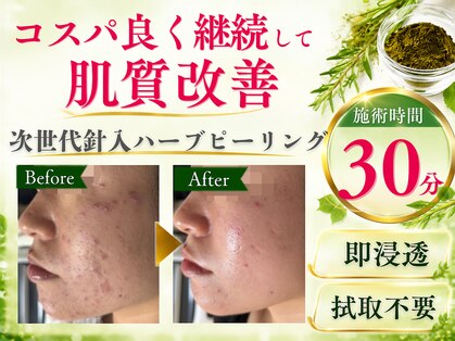 ウル(Uru)の写真