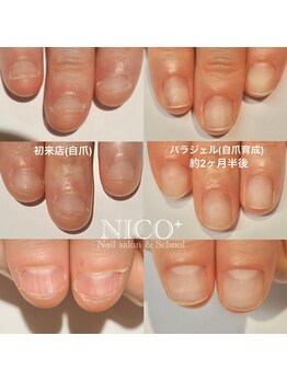 ニコプラス(NICO+)/深爪育成パラジェルクリア補強