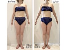 ルヴィカカリーナ(REVI Cacalena)/全身リンパボディメイクコース