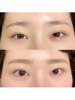 ジェイ(J)/お目元ガラッと印象チェンジ