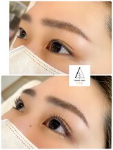 ツリー(tree)/ラッシュリフト