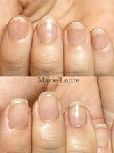 マリーロール 淀屋橋本店(Marie Laure)/自爪育成/深爪矯正/ネイルケア