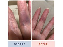 サロン ミー(salon Mee)の雰囲気（【コラーゲンマシーン30分の効果】）