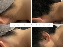 アンブロッサム(An Blossom)の雰囲気（都度払いOK！全身脱毛/ヒゲ脱毛/VIO脱毛/顔脱毛/脇脱毛/部分脱毛）