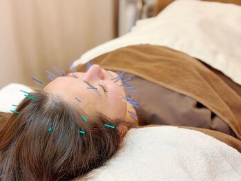 こじま 富雄団地接骨院/ヒト幹細胞美容鍼