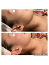 アユスリム(AYU SLIM)/一回でも変化できるの充実小顔