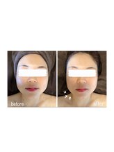 salon結(yui)/小顔筋膜ケア