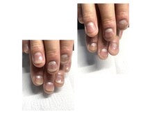 デジール(Desir)の雰囲気（ライフスタイルに合った深爪矯正の進め方をご提案します。）