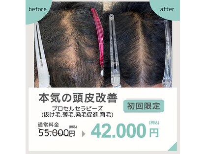 ヒルナム(Heal Nam)の写真