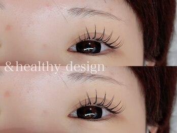 ユーロ(EURO)/アンドヘルシー