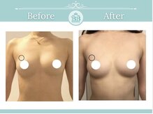 美人バスト 赤羽店の雰囲気(育乳のプロが育たない原因を徹底解明★バストアップは叶えられる)