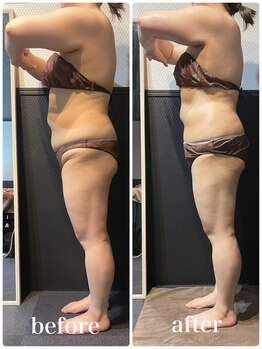 ピーラトゥ 日立(P-Ratu)/ブライダルコース