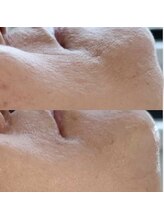 ルルアス(LuLu AS)/大人気韓国リジュラン！