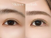 ミニョン(Mignon)