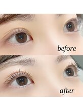 アイ(_i)/ラッシュリフト