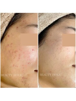 ビューティーホリック 蘇我店(BEAUTY HOLIC)/
