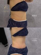 クレビア(CREBIA)/