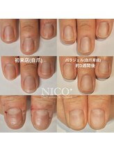 ニコプラス(NICO+)/深爪育成パラジェルクリア補強