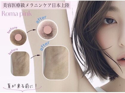 アンヘル(Angel)の写真