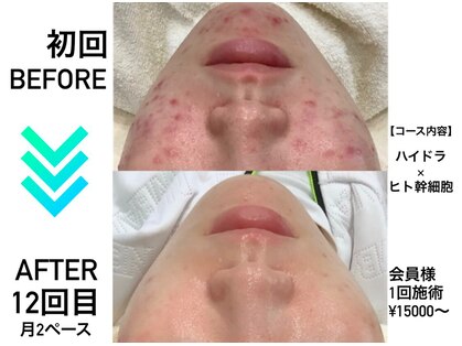 リンフェイス 浦安店(RINFACE)の写真
