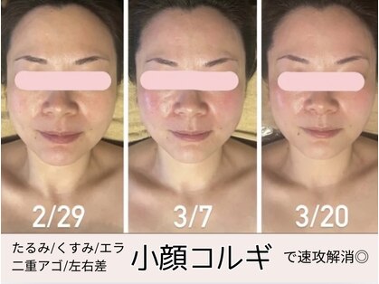 プリュボーテ(Pul Beaute)の写真