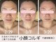 プリュボーテ(Pul Beaute)の写真