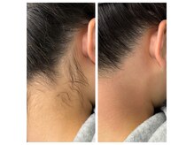 エピリア(Epilear)の雰囲気(一回で綺麗になれる痛みの少ない国産Waxを使用★)