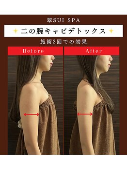ブライダルエステ バイ スイスパ表参道(BRIDAL ESTHE by SUI SPA)/【痩身】ボディBefore→After