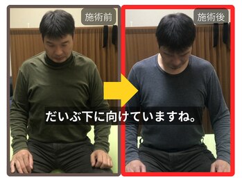 まこと整骨院/ずっと取れない長引く肩の痛み２