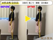 幸せのもり整体院/【40代女性／会社員】Yさん