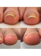 ウェルズユキ(well's yuki)/