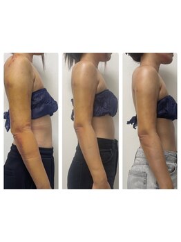 短期集中コースのあるサロン