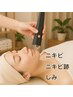 【人気NO.1】浸透×殺菌で肌質改善。今こそプラズマ体験！しみ、ニキビ◎