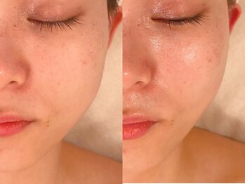 ホワイトカメリア(White Camellia)/【小顔矯正】