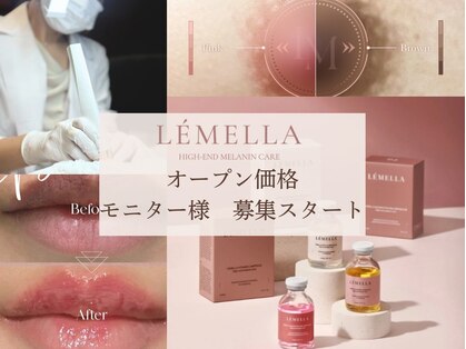 レアローズ(LE'A ROSE)の写真