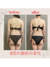 ビオラ(美ola)/身体が整うと痩せ見え効果も◎