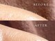 ファゴッド(FaGOD)の写真