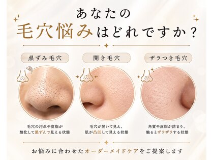 リベルテ 岡山(liberte)の写真