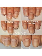 ニコプラス(NICO+)/自爪育成パラジェルクリア補強