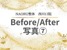 ナオル整体 西川口院(NAORU整体)/西川口 蕨 戸田 整体 骨盤矯正