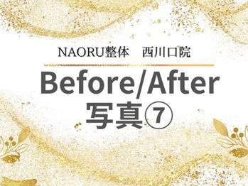 ナオル整体 西川口院(NAORU整体)/西川口 蕨 戸田 整体 骨盤矯正