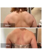 シュシュ(Chou chou)/痩身 Before＆After