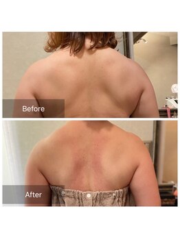 シュシュ(Chou chou)/痩身 Before&After