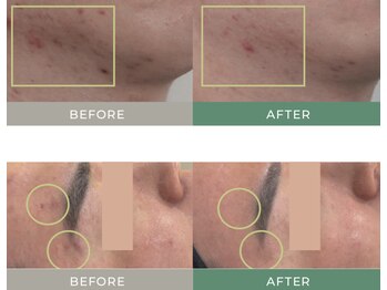 デラッセ サロン ギンザ 藤枝店(Delasser salon GINZA)/韓国iLLONアクチューン