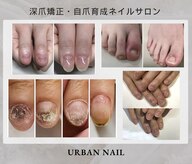 アーバンネイル