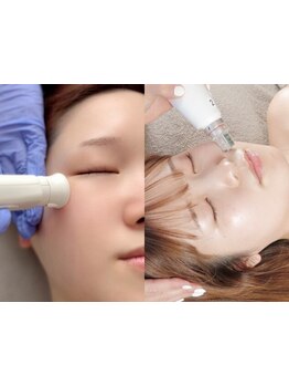 ホウレイ線・たるみ改善！予防ケア