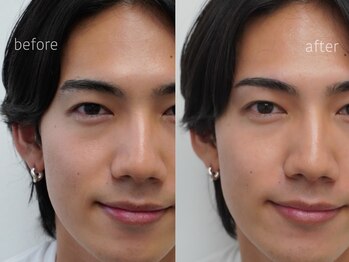 ワクシー 麻布十番店(WAXYYY.)/ハリウッドブロウリフト¥3,900～