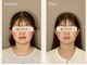 ビオラス(VIOLAS)の写真/《国家資格保持の女性施術者が担当/完全個室の女性専用美容鍼灸サロン》 肌質改善・リフトアップ・小顔◎