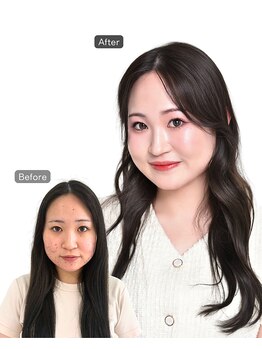 ビューティースタイル 千葉(BeautyStyle)の写真/－５歳肌でキレイ見えするパーソナルカラー診断！くすみが気になる大人女子に◎〈骨格診断・顔タイプ診断〉